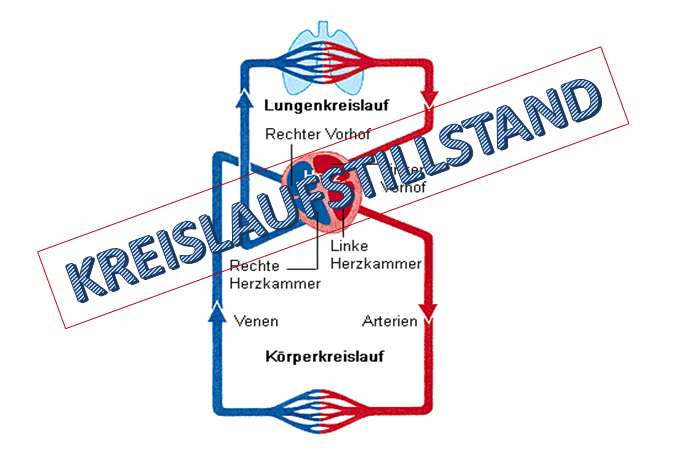 Mensch - Kreislaufstillstand